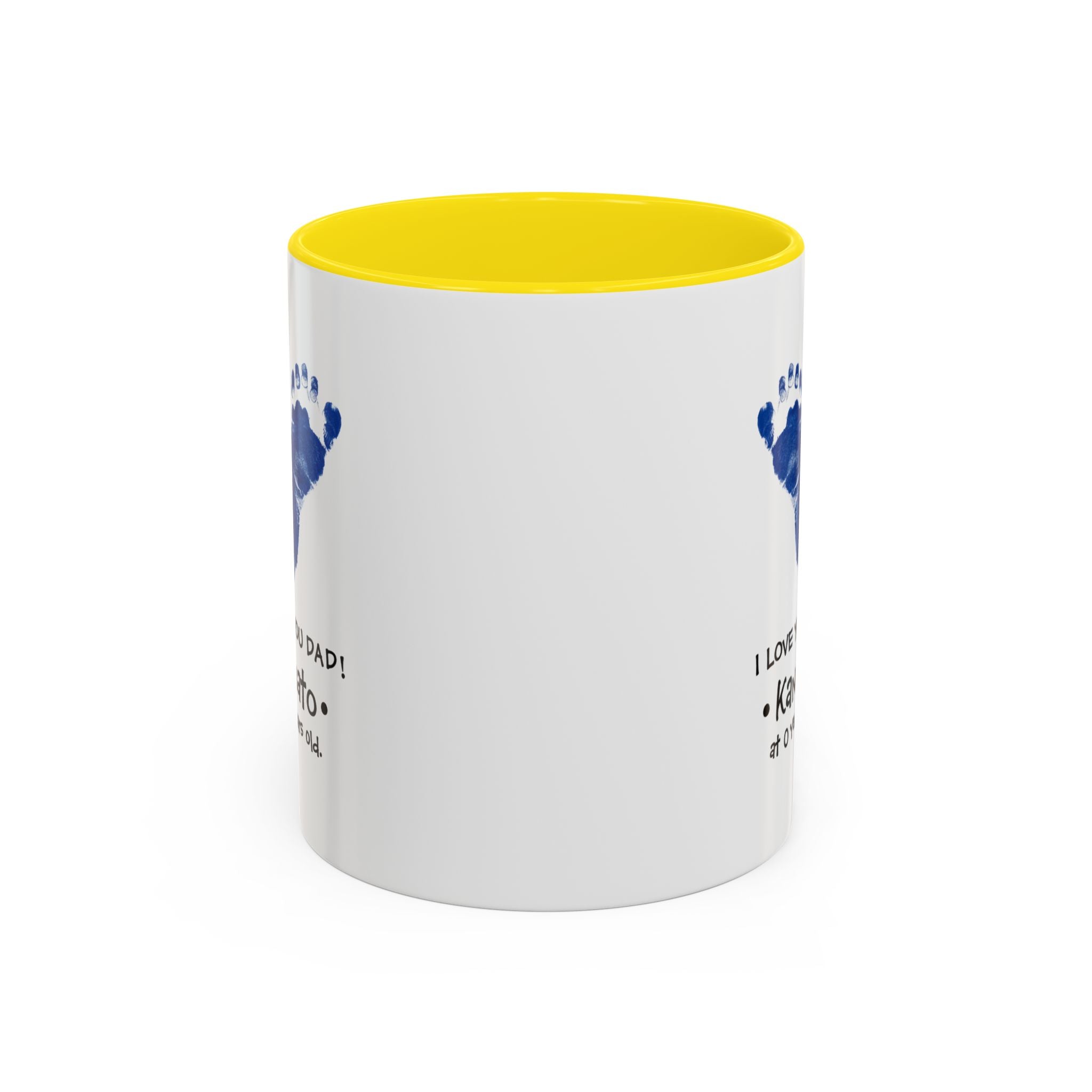 dad  Accent Coffee Mug (11, 15oz)